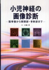 �����_�o�̉摜�f�f
