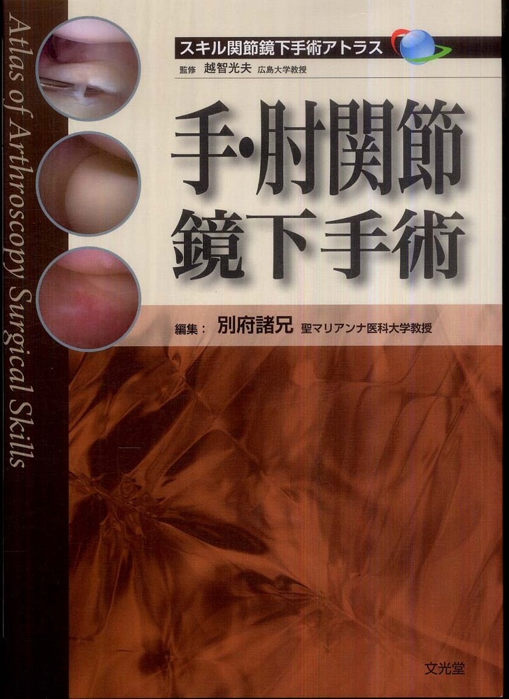 手・肘関節鏡下手術 文光堂 激安価格: 野呂肉のブログ