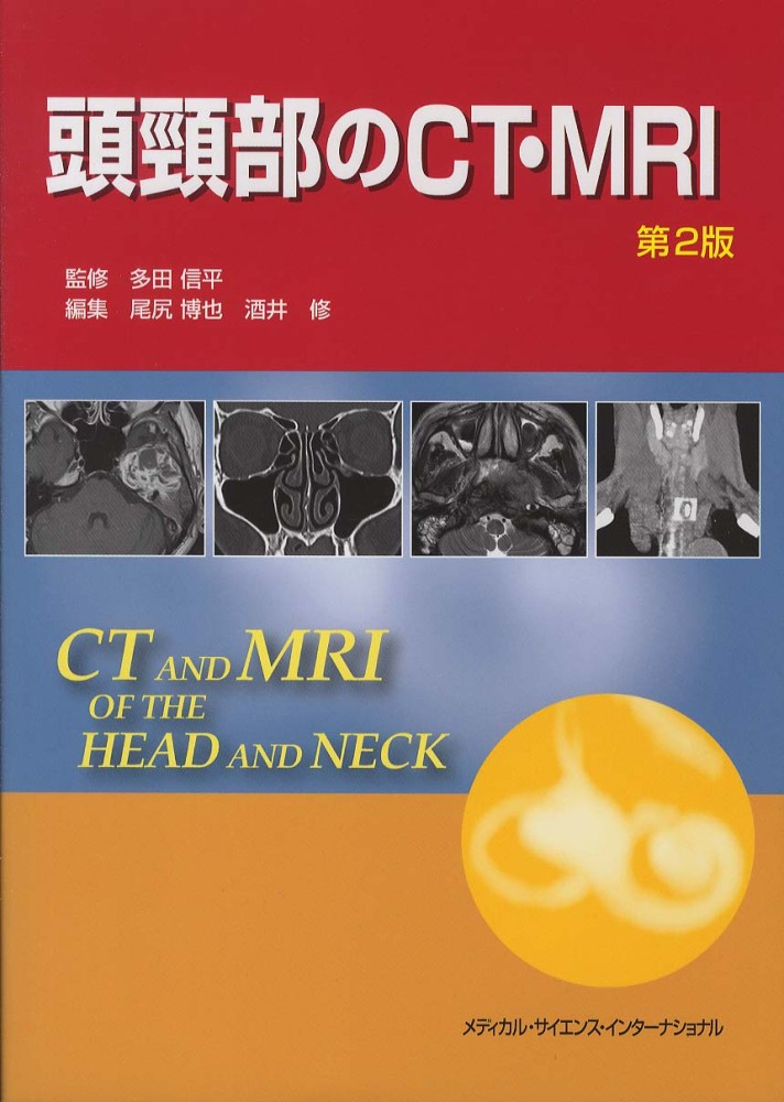 頭頚部のct・mri メディカル・サイエンス・インターナショナル 最安値 石沢たなかのブログ