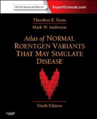 Atlas of normal roentgen variants that may simulate disease