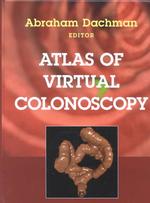 Atlas of virtual colonoscopy
