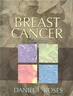 Breast cancer. - 2nd ed.