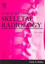 Fundamentals of skeletal radiology