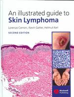 An illustrated guide to skin lymphoma. - 2nd ed.