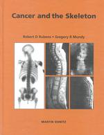 Cancer and the skeleton