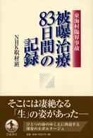 被曝治療83日間の記録 東海村臨界事故