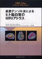 拡散ﾃﾝｿﾙ法によるﾋﾄ脳白質のMRIｱﾄﾗｽ