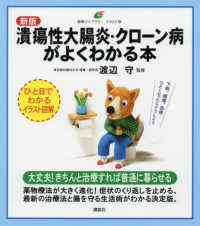 潰瘍性大腸炎・クローン病がよくわかる本 健康ライブラリー : イラスト版