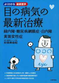 目の病気の最新治療 緑内障・糖尿病網膜症・白内障・黄斑変性症