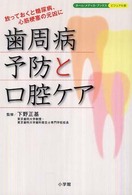 歯周病予防と口腔ケア 放っておくと糖尿病、心筋梗塞の元凶に ホーム・メディカ・ブックス・ビジュアル版