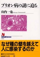 プリオン病の謎に迫る NHKブックス