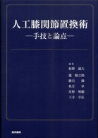 人工膝関節置換術 手技と論点
