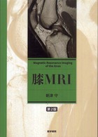 膝MRI