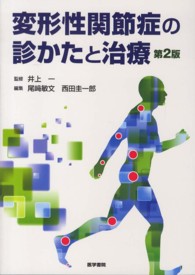 変形性関節症の診かたと治療