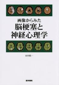 画像からみた脳梗塞と神経心理学