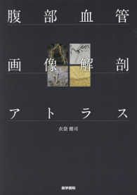 腹部血管画像解剖アトラス