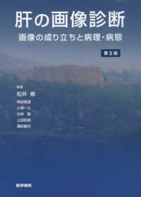肝の画像診断