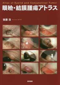 眼瞼・結膜腫瘍アトラス Atlas of eyelid and conjunctival tumor
