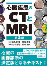 心臓疾患のCTとMRI