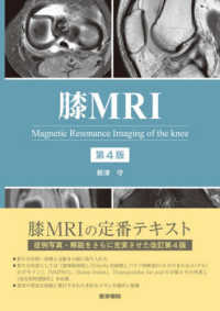 膝MRI