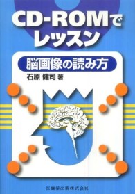 CD-ROMでﾚｯｽﾝ脳画像の読み方