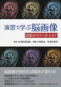 演習で学ぶ脳画像 読影からリハ介入まで
