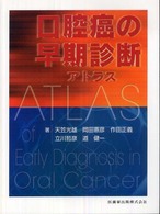 口腔癌の早期診断アトラス