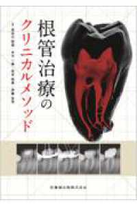 根管治療のクリニカルメソッド