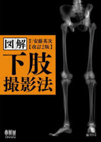 図解下肢撮影法