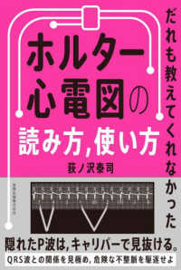 ホルター心電図の読み方,使い方 だれも教えてくれなかった