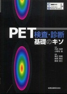 PET検査・診断 基礎のキソ