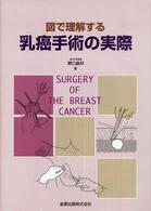 図で理解する乳癌手術の実際