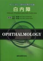 白内障 すぐに役立つ眼科診療の知識
