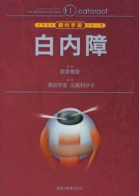 白内障
