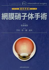 網膜硝子体手術 Vitreoretinal surgery