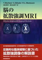 脳の拡散強調MRI