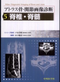 脊椎・脊髄
