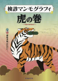 検診マンモグラフィ虎の巻