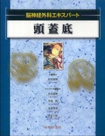 頭蓋底