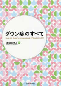 ダウン症のすべて