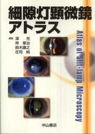 細隙灯顕微鏡ｱﾄﾗｽ