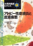 アトピー性皮膚炎と皮膚疾患
