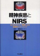 精神疾患とNIRS