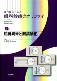 屈折異常と眼鏡矯正