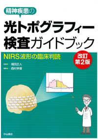 精神疾患の光ﾄﾎﾟｸﾞﾗﾌｨｰ検査ｶﾞｲﾄﾞﾌﾞｯｸ NIRS波形の臨床判読
