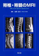 脊椎・脊髄のMRI