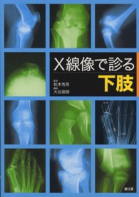X線像で診る下肢