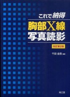 これで納得胸部X線写真読影