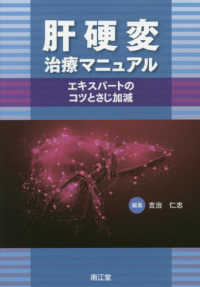 肝硬変治療マニュアル エキスパートのコツとさじ加減