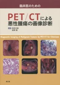 臨床医のためのPET/CTによる悪性腫瘍の画像診断 Diagnostic imaging of malignant tumors by PET/CT for clinicians